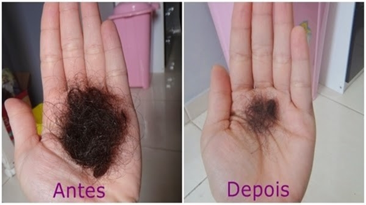 Queda de Cabelo: Melhores Receitas Caseiras Para Evitar