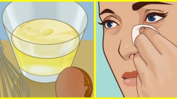 Como Remover Olheiras Usando Esta Receita Natural