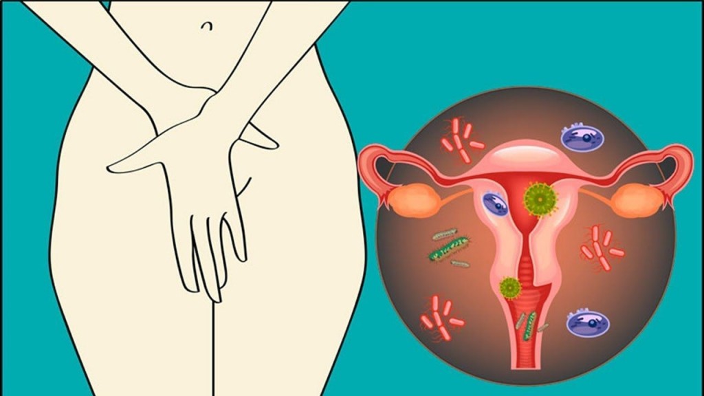 Como Tratar Infecção Vaginal Por Fungo com Remédios Caseiros!