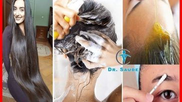 queda de cabelo