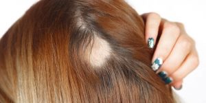 dicas para fazer o cabelo parar de cair