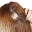 dicas para fazer o cabelo parar de cair