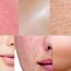 quais os tipos de pele